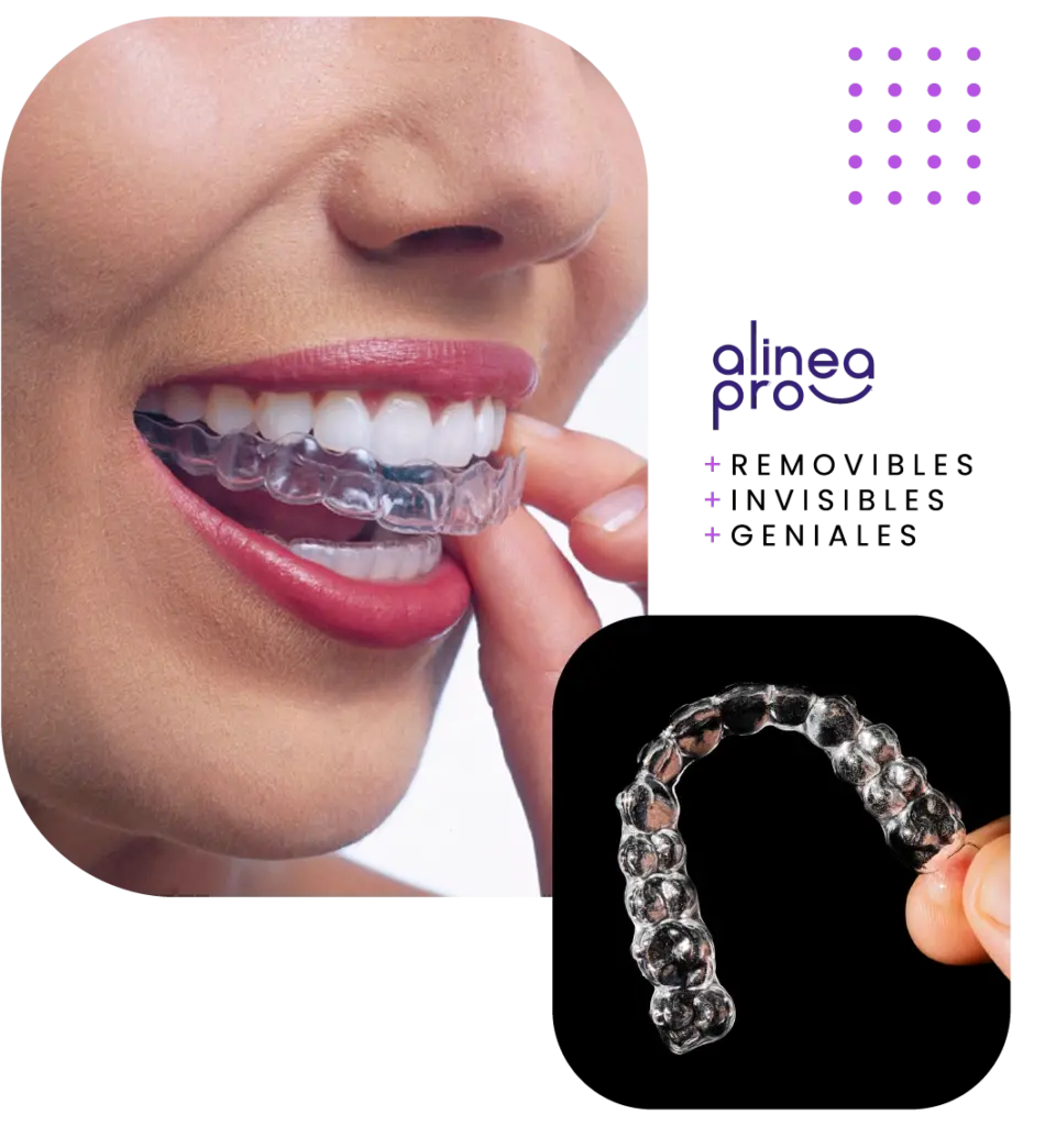 Ortodoncia Invisible con alineadores removibles Odontoestetica AlineaPro